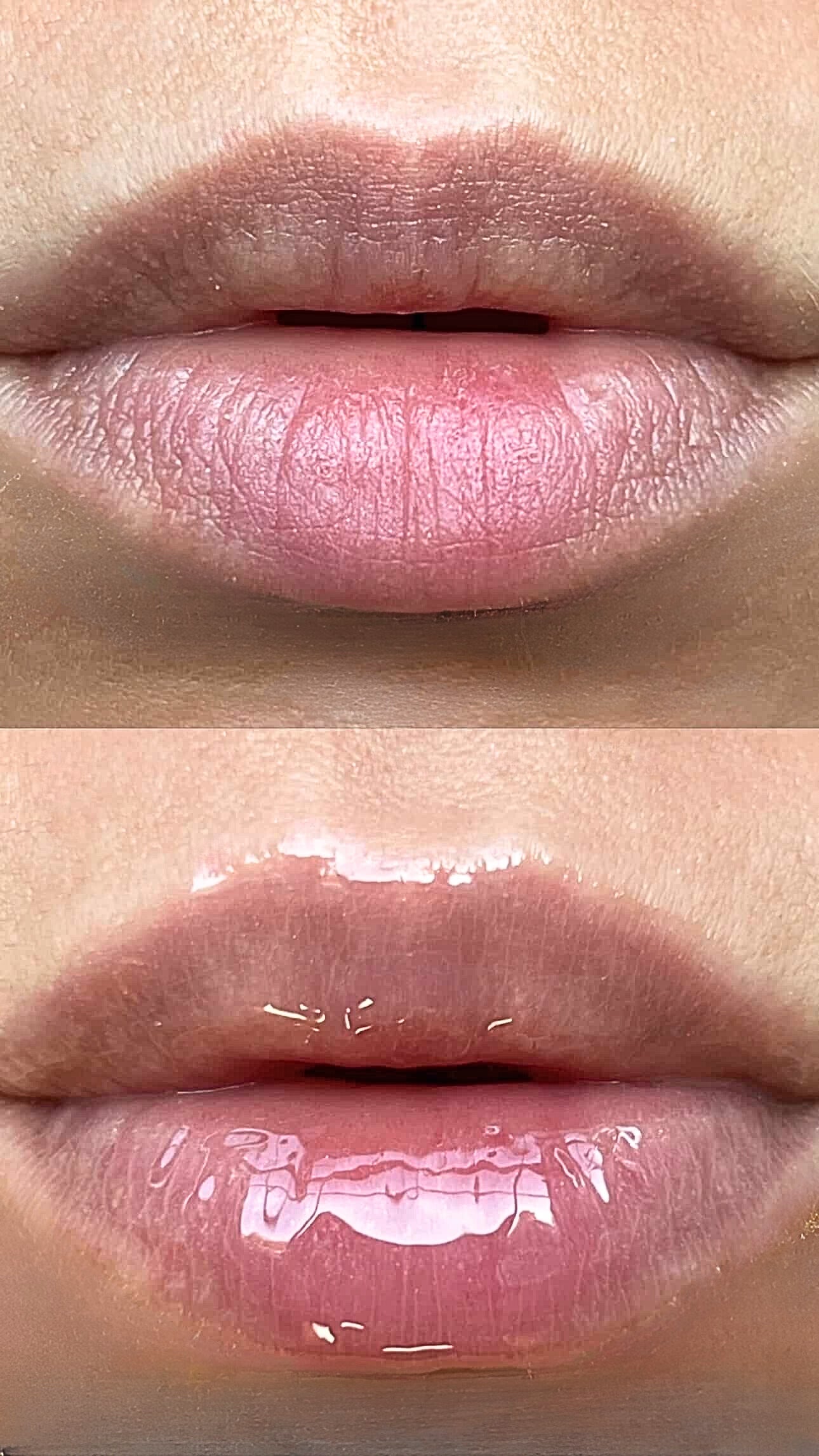 Lip Hybrids